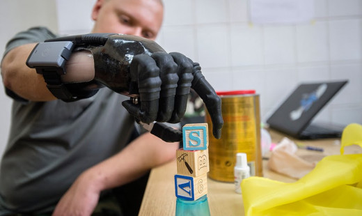 bionic hand protez hub