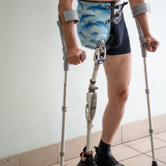 protez hub complex prosthetic leg Ukraine